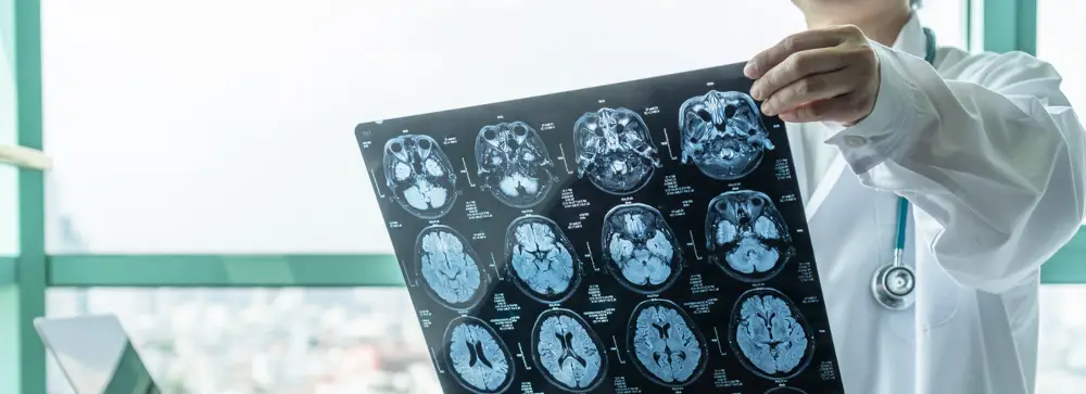 Doctor reviewing brain scan MRI images in a hospital